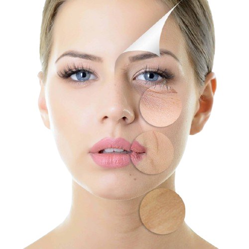 Under Eye Fillers